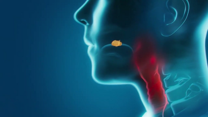 Isla TVC Kampagne MOA